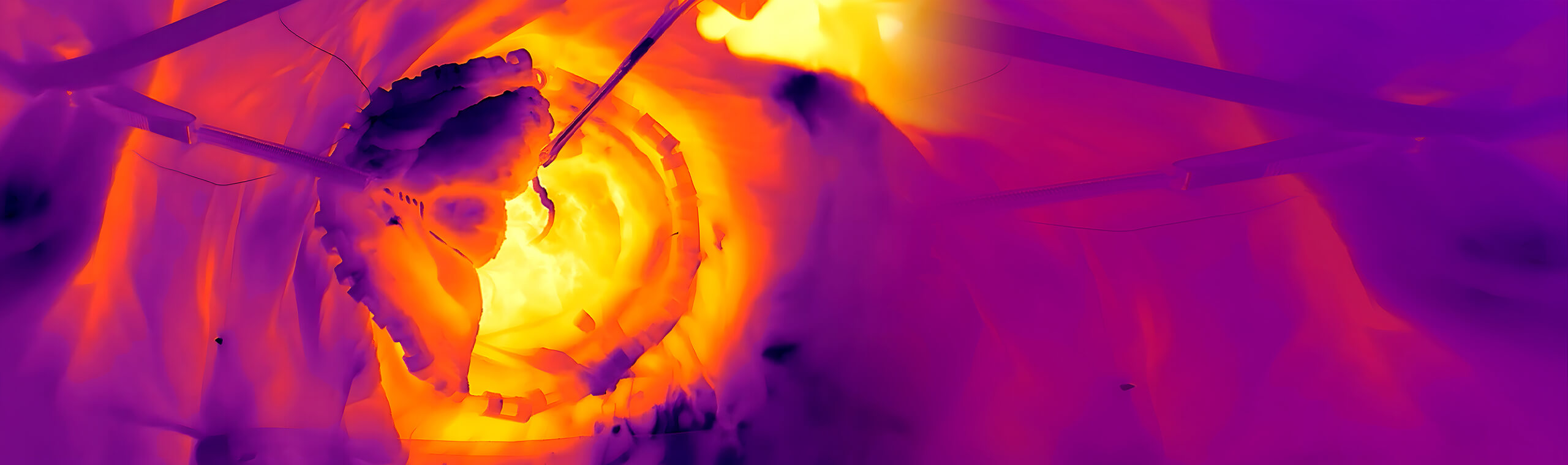 工業(yè)自動化